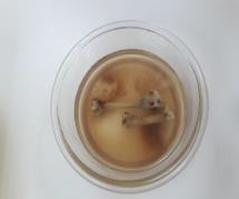 descalcificacion-del-hueso1