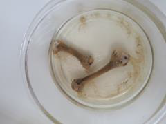 descalcificacion-del-hueso2